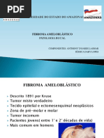 Fibroma Ameloblasto