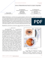 An Approach To The Detection of Retinoblastoma Based On Apriori Algorithm