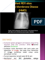 Hialin Membrane Disease