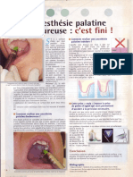 2007 Villette L'anesthésie Palatine Douloureuse C'est Fini Le Fil Dentaire PDF