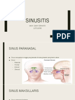 Sinusitis