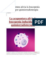 La Acupuntura Alivia La Leucopenia Inducida Por Quimiorradioterapia