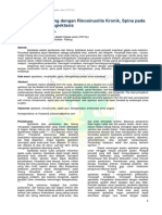 Epistaksis berulang dengan rinosinusitis kronis, spina pada septum, dan telangiektasis.pdf