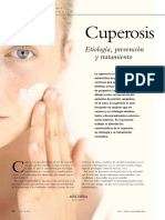 Cuperosis: Etiología, Prevención y Tratamiento