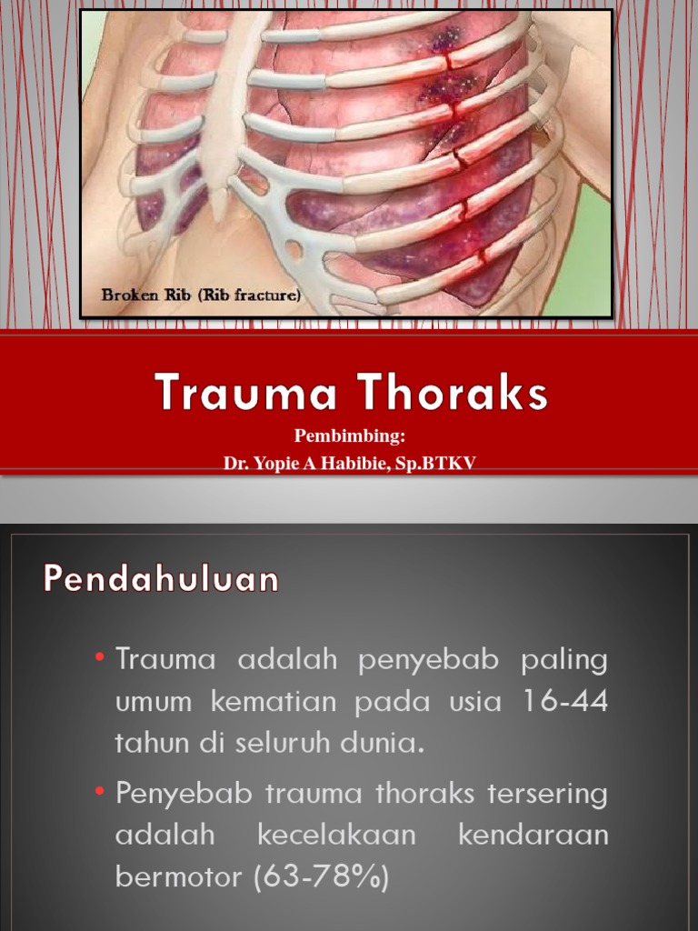 Presentasi Trauma Thoraks FIX | PDF