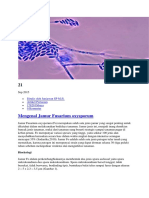 Mengenal Jamur Fusarium Oxysporum: Ditulis Oleh Juniawan SP M.Si. Artikel Pertanian 17820 Dibaca 0 Komentar