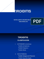 Tiroiditis