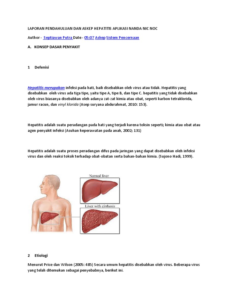 Laporan Pendahuluan Dan Askep Hepatitis Aplikasi Nanda Nic Noc