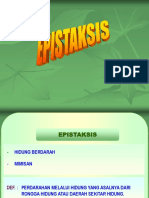 epistaksis,