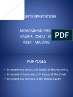 CXR INTERPRETATION.pptx