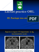 Lucrari Practice ORL III Patologie Rino Sinusala