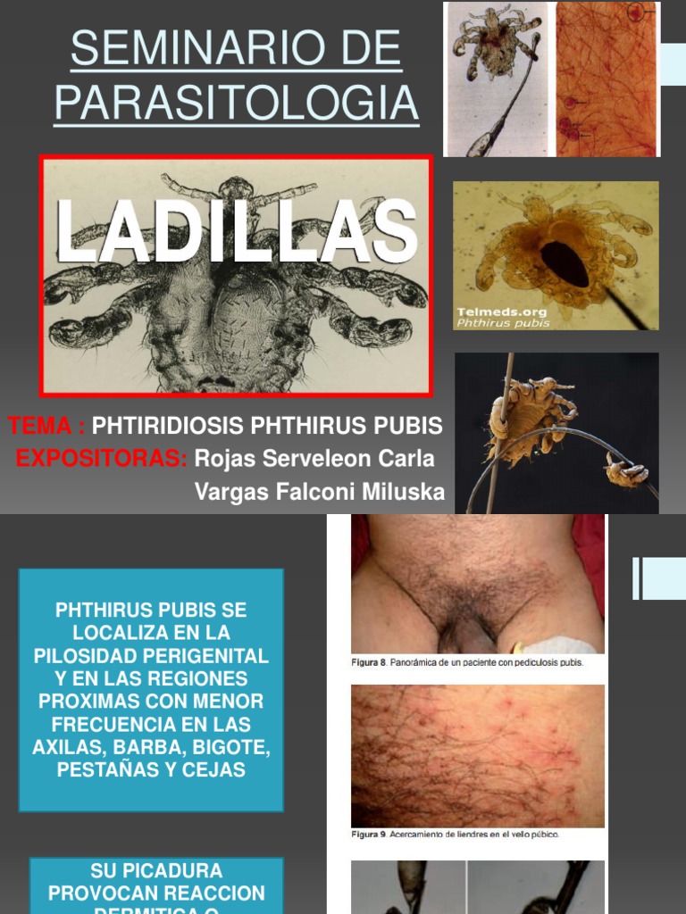 Phtiriasis: Ladillas y su Tratamiento | PDF | Salud y bienestar | Medicina