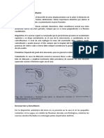 Ventroversión Y Ventroflexión Dos