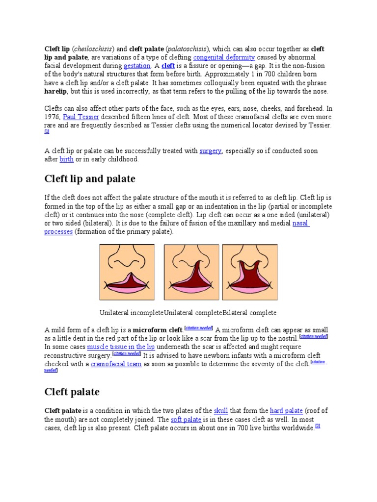 Cleft Lip Research Paper