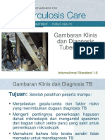 ISTC Diagnosis TB