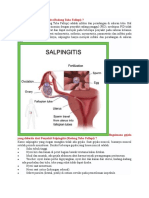 Apa Itu Penyakit Salpingitis