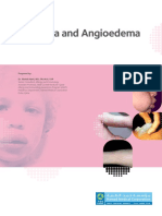 Urticaria and Angioedema en