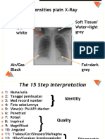 Radiologi CXR Interpretation Lecture SRGOETTI