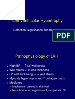 ECG LVH Sensitivity