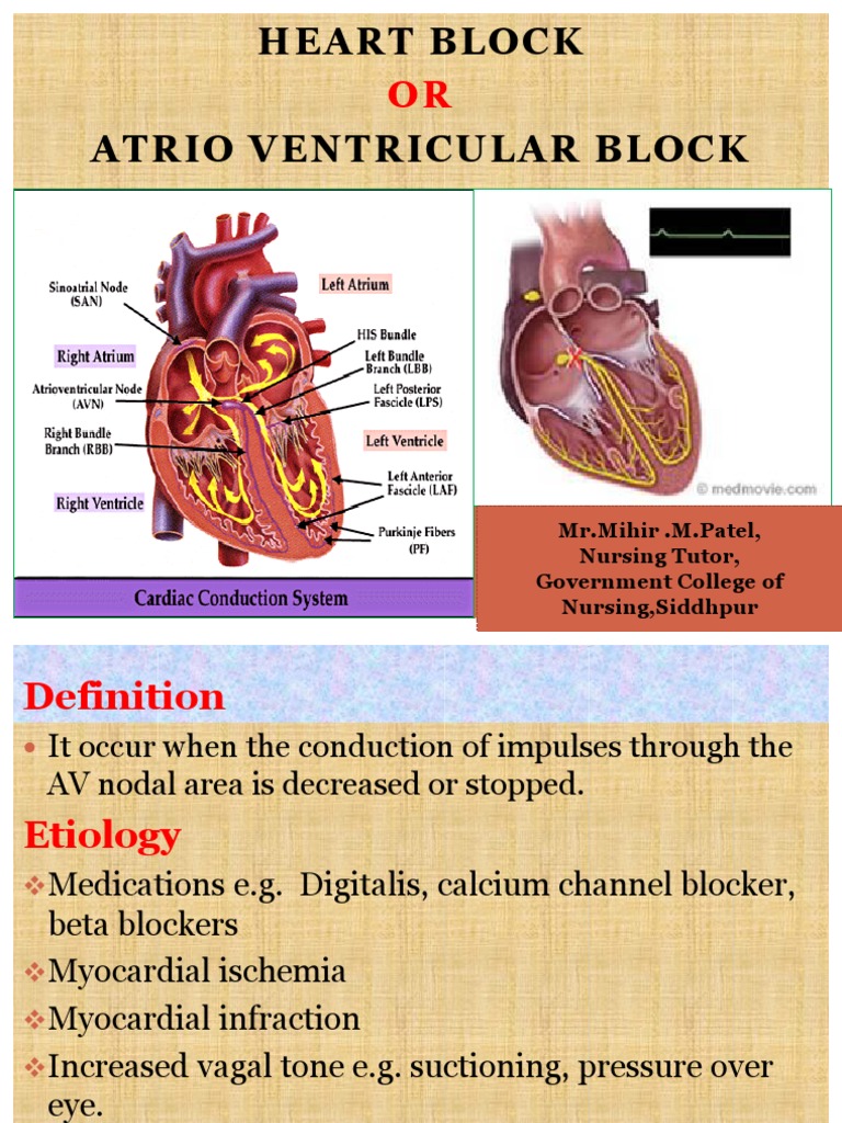 causes-of-heart-block-disease-mn-heart
