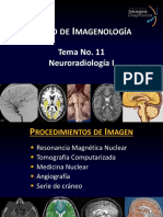 Tema 11 Neuroradiología I