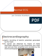 Normal ECG Waveforms and Intervals Explained