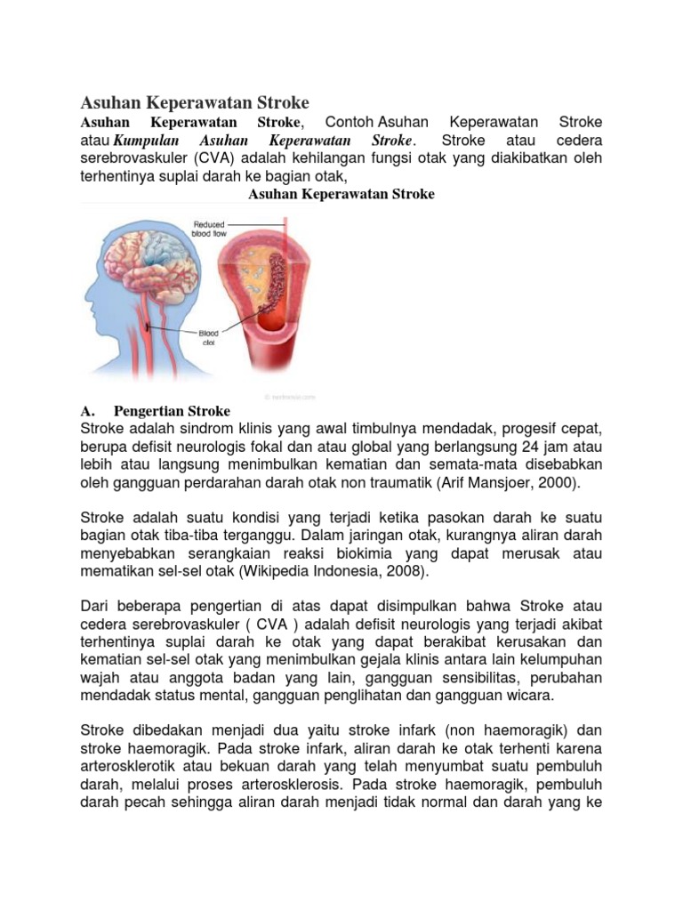 Contoh Askep Stroke Infark - Simak Gambar Berikut