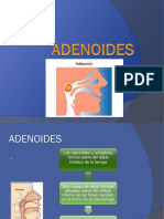 Adenoid Es