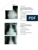 Review Radiologi Foto Thoraks