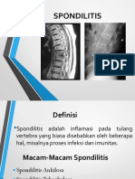 Spondilitis TB