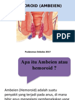 Hemoroid (Ambeien