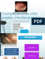 OTORRINO 2 Otitis Media Complicaciones