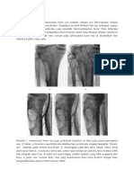 Angiografi ABC