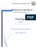 Teratocarcinoma de ovario: reporte de laboratorio