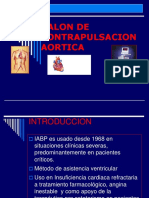 Balón de contrapulsación aórtica: indicaciones, funcionamiento y complicaciones