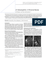 Osteomyelitis PDF