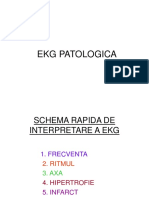 Ekg Patologica