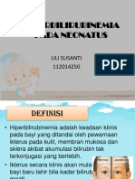 Hiperbilirubin Pada Neonatus FIX