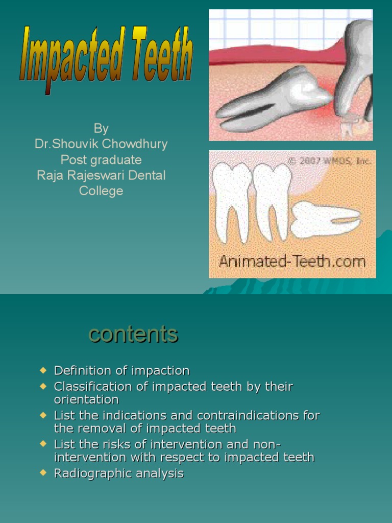 Impaction PDF Human Tooth Face