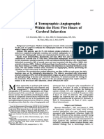 Penemuan Pada CT Angiografi Cerebral Infarction