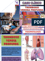 casoclnicotrombosisvenosaprofunda-140611144540-phpapp02