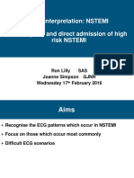 ECG Interpretation: NSTEMI Primary PCI and Direct Admission of High Risk NSTEMI