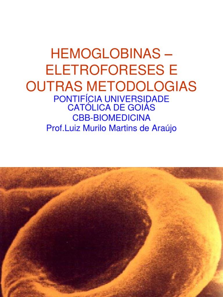 Eletroforese de Hemoglobina | PDF | Ciências Físicas | Biologia