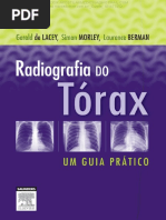 - Radiografia Do Tórax - Um Guia Prático - Lacey PT