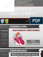 Insuficiencia Tricuspidea