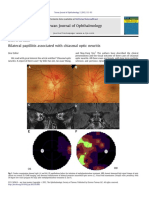 Neuritis Optic Case Report