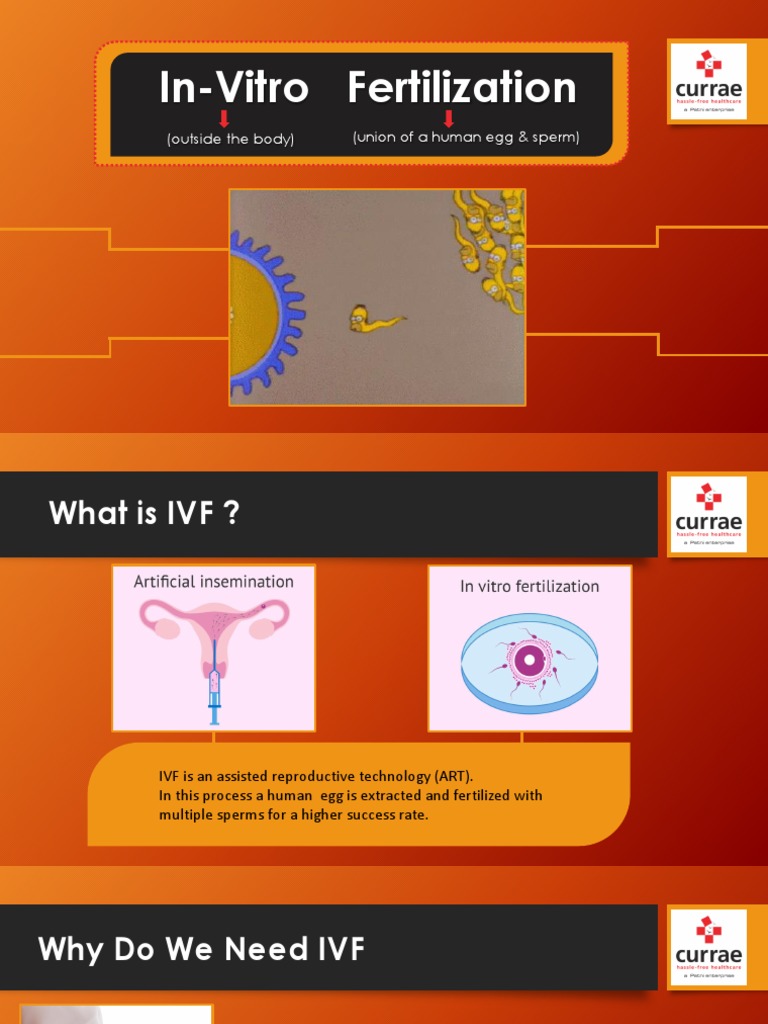 Explore Your Options With in Vitro Fertilization | PDF | Self ...