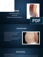 Ascitis: Causas, Diagnóstico y Clasificación