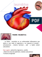 fiebrereumticaaguda2010-170925144527