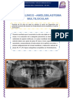 Caso Clinico Ameloblastoma